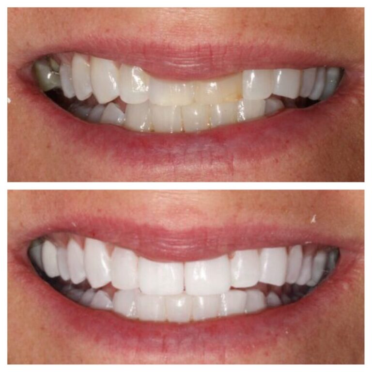 our client show theet before quality and after