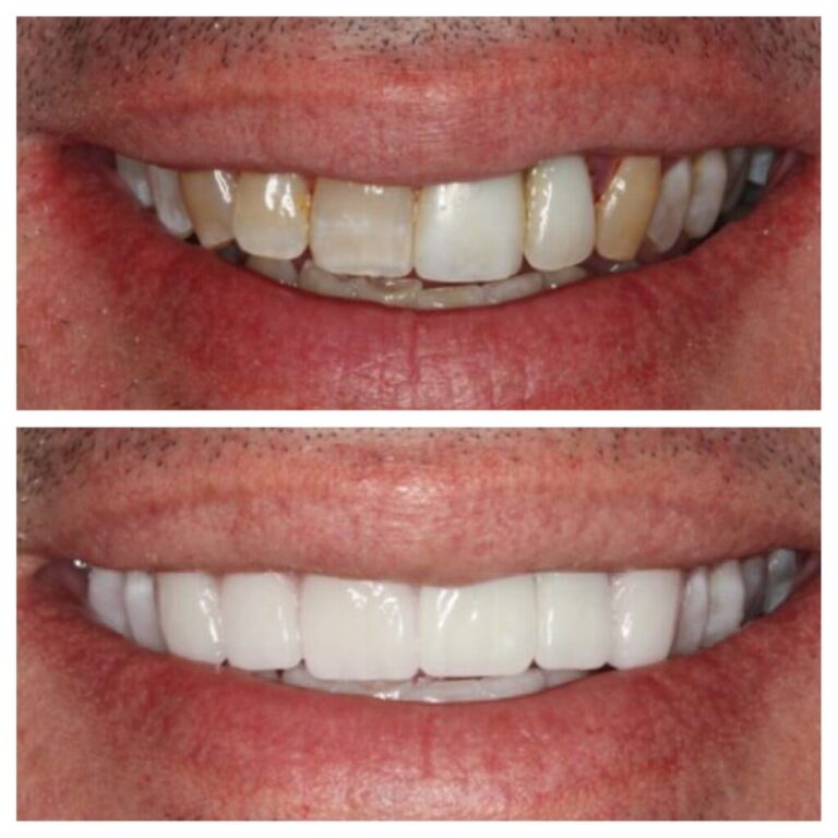 our client show theet before quality and after