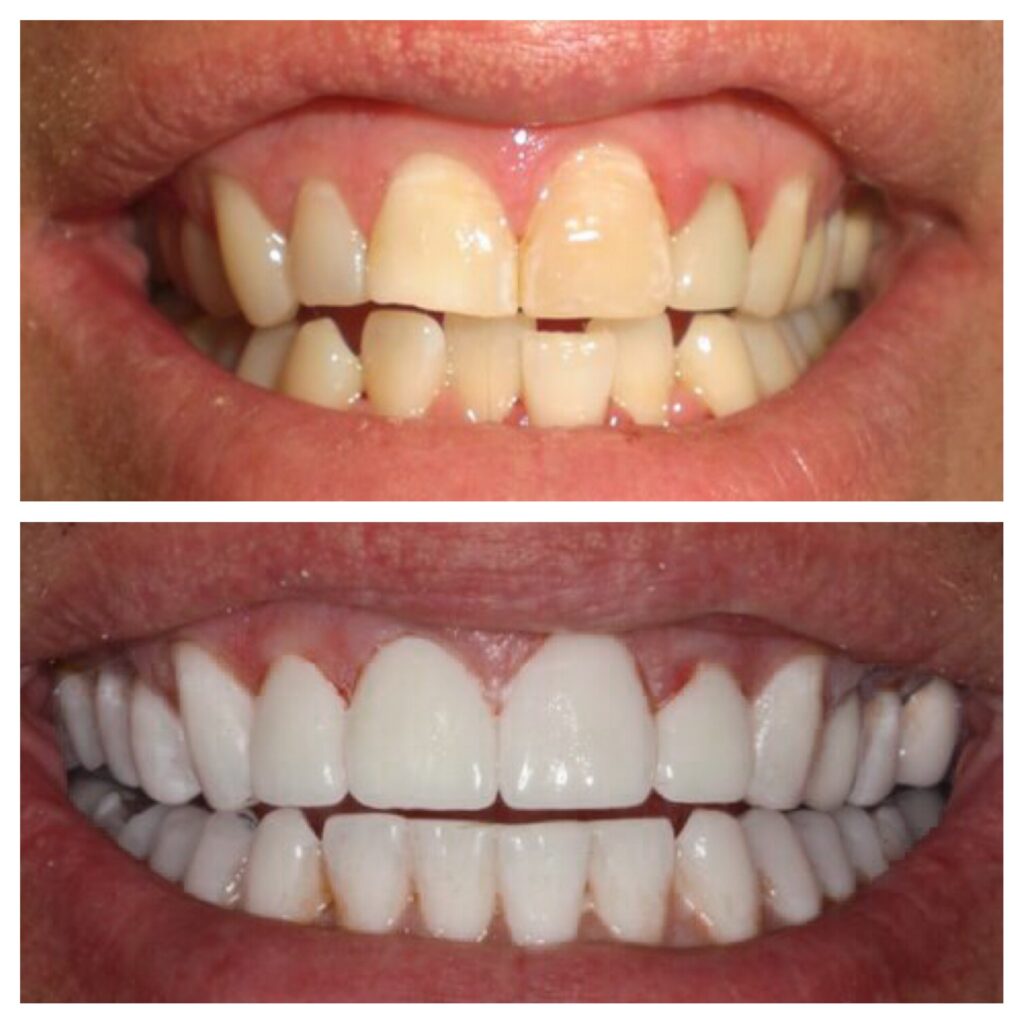 our client show theet before quality and after