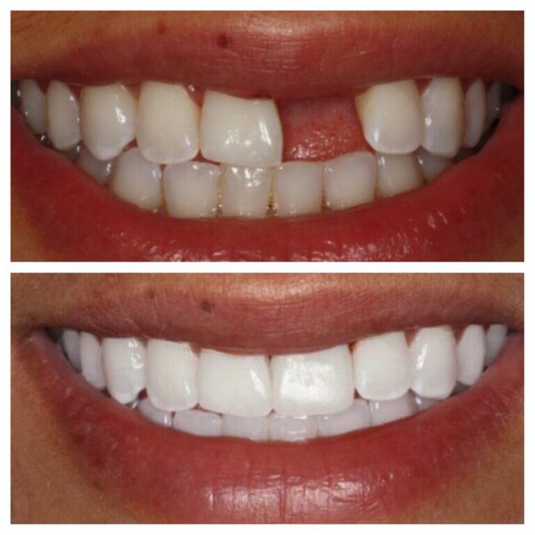 our client show theet before quality and after