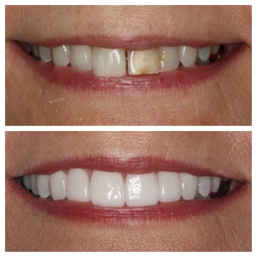 our client show theet before quality and after