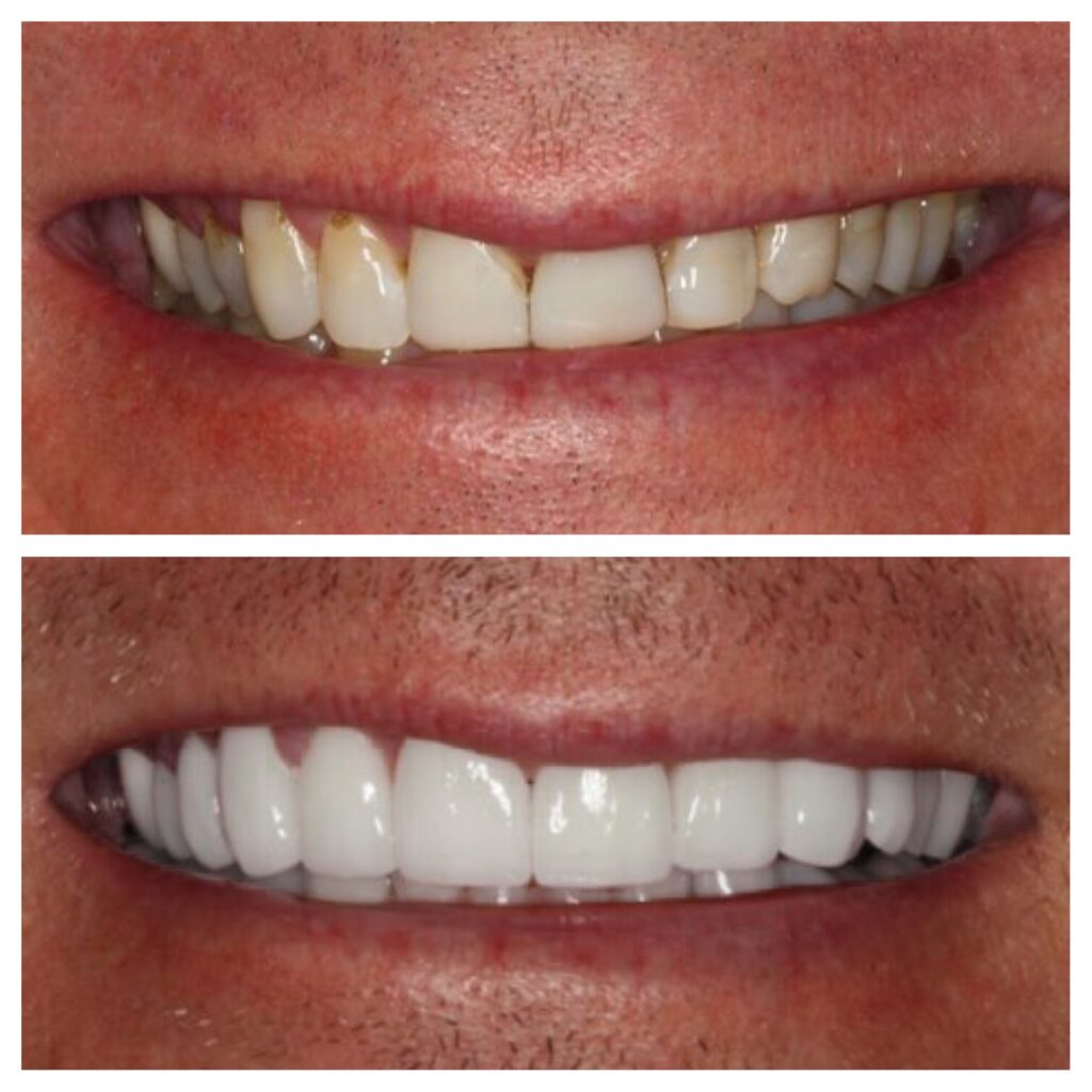 our client show theet before quality and after