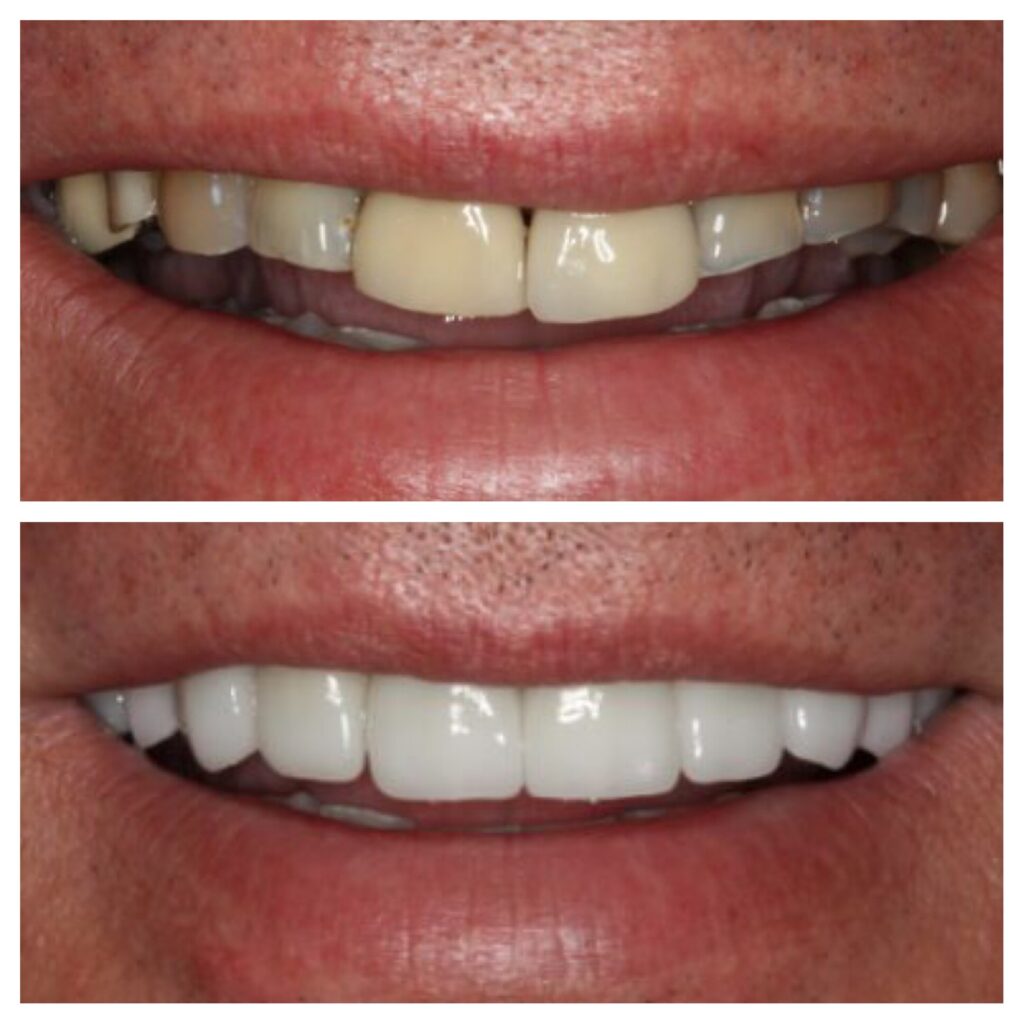 our client show theet before quality and after