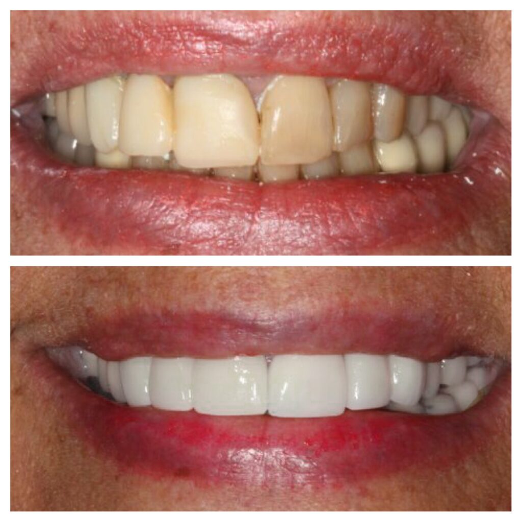 our client show theet before quality and after