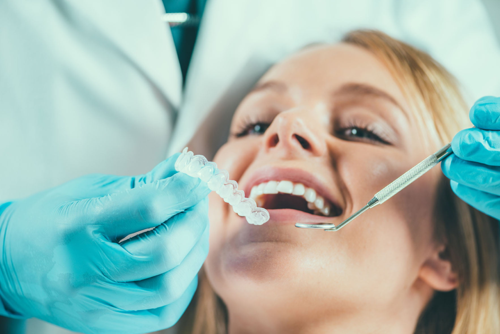 invisalign installation