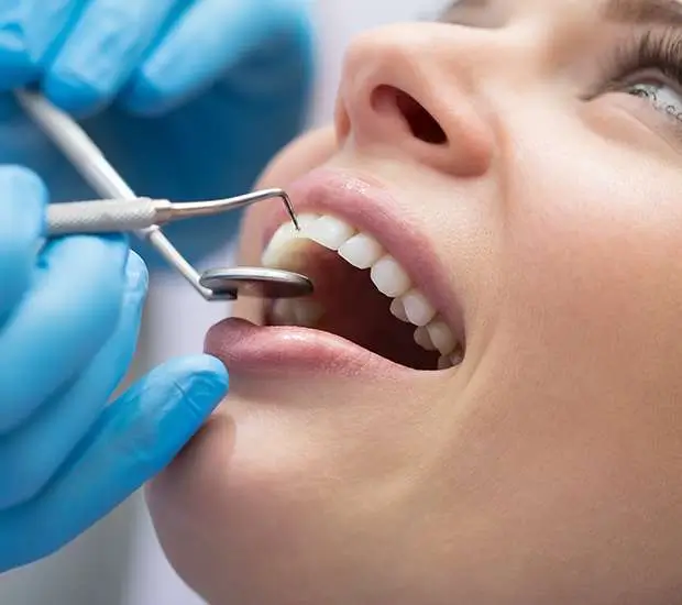 Dental Bonding Fort Lauderdale