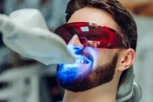 Teeth Whitening services in fort lauderdale