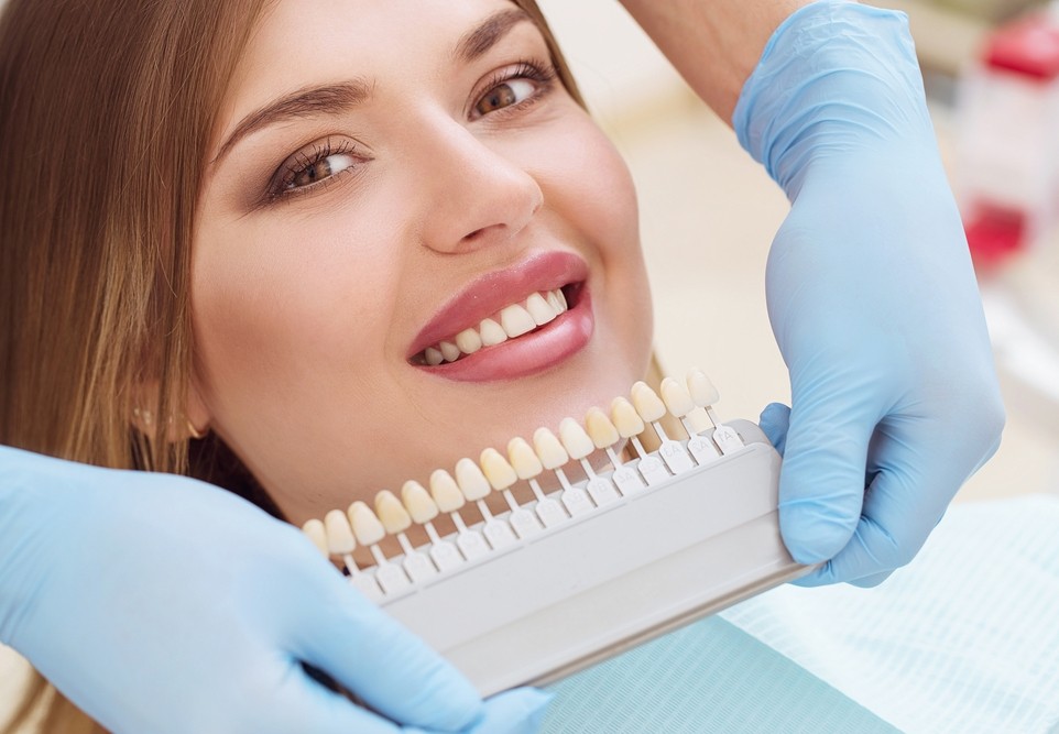 Porcelain Veneers Services in Fort Lauderdale